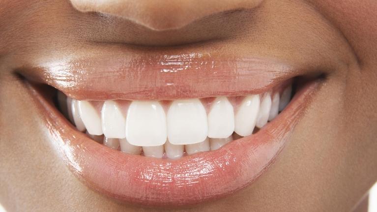 7 Things You Didn't Know About Your Teeth